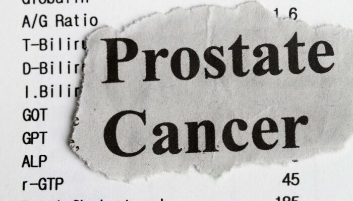 Prostate Cancer Risk Factors
