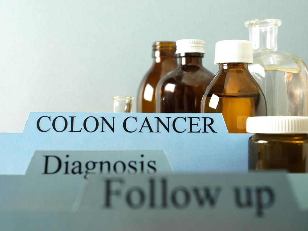 Treatments for Colon Cancer